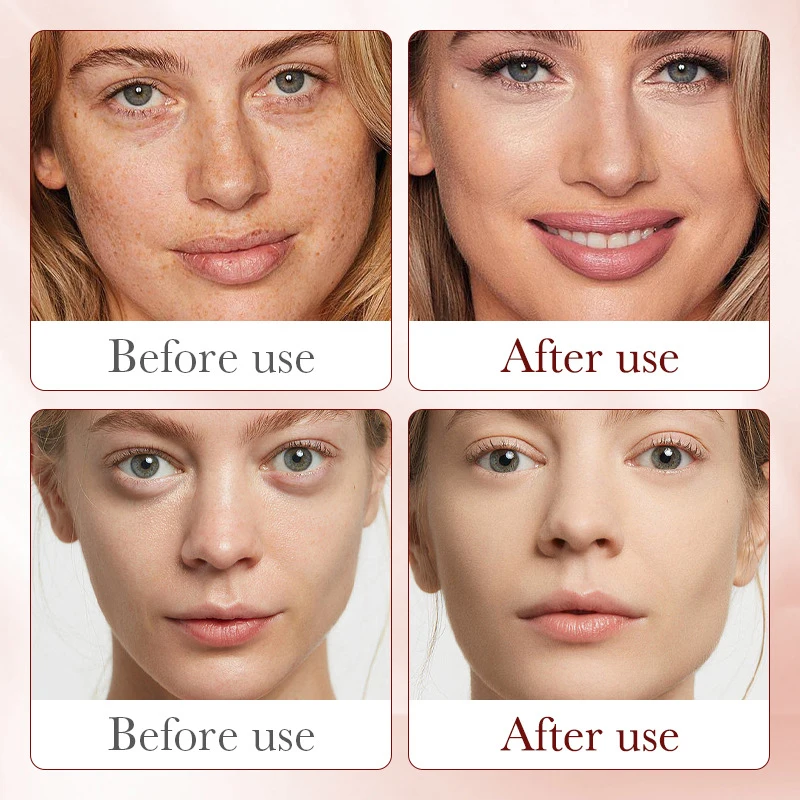 로얄 드래곤 혈액 세럼 태반 회춘 보습 스무딩 페이셜  - Placenta Extract Serum 리뷰 및 가격